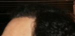 6.5 months Left Side .JPG