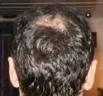 6.5 Months Donar .JPG