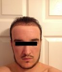 Wonky Hairline.jpg