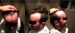 Pre-Op Montage.png.jpg