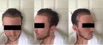 Post-Op Montage.png.jpg