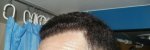 Left  Side 7 month .JPG