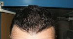 Front 1. 7 month.jpg