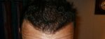 Front Tilt 7 month Gel .JPG