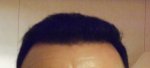 7.5 Months 14-09-12 hairline.JPG