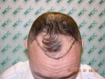 BeforeOp Top Down 01-02-12 .JPG