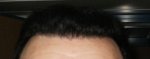 hairline 24-09-12.jpg