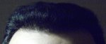 Hairline 24-09-12 (2).jpg
