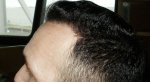 Left Side 8 month.JPG