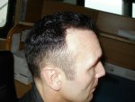 Right Side 8 Month .JPG