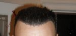 Hairline front Wet 26-10-12.JPG