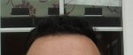 Hairline 9 Month outside.JPG