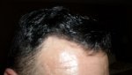 Right Side.JPG