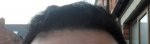 Front Hairline 10 Month.JPG