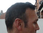 Right Side 10 Month.JPG