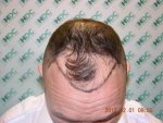 Before HT 01-02-12.JPG