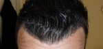10 Month Gel Back Tilted.JPG