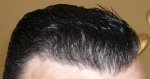 10 month Gel Back Right Side.JPG