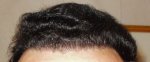hairline  10.5 months .jpg