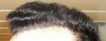 left side 10.5 months.jpg
