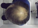NF 2 after.jpg