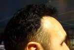Right Side - 12 month Result A .jpg