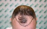 Pre Op Tilted 01-02-12.JPG