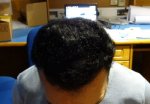 Tilted 12 Month Result .jpg
