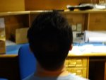 Donar from Back 12 month result.jpg