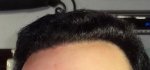 HAIRLINE.jpg