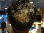 Crown 16 Weeks Post Op.jpg