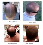 hairlossproductreview.jpg