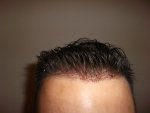 Front of head 2013.jpg