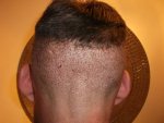 Back of head 2013.jpg