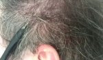 left side 1 Feb 2013.jpg