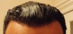 Front Gel Back 13 month.jpg
