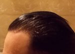 Left Side Gel Back 13 Month.jpg