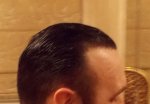 Right Side Gel back 13 Month.jpg