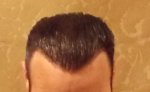 Gel Back 13 Month.jpg