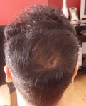 Crown hair combed forward to show the swirl 12-03-13.jpg