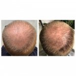 3month update_before and after 1.jpg