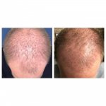 3month update_before and after 2.jpg