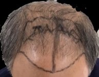 Before.jpg