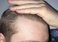 5 month right.jpg