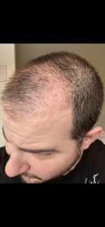 E03A085E-9297-45D7-95C6-25F277B30976.png