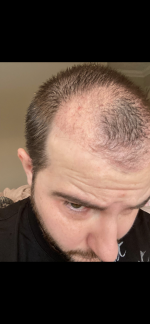 B590ABAE-3123-4711-81F2-B2C59BEDC705.png
