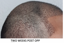 2 weeks pic 2.png