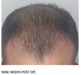 9 weeks.png