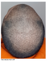2 weeks pic 3.png