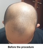 before1.jpg